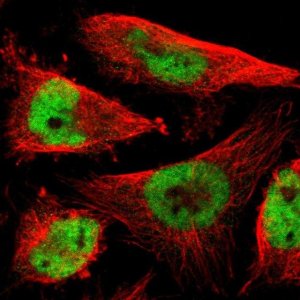 Anti-RNF38 antibody produced in rabbit 