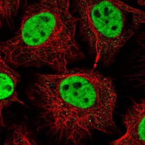 Anti-RNF40 antibody produced in rabbit 