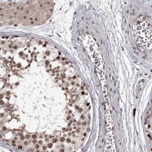 Anti-RNF44 antibody produced in rabbit 