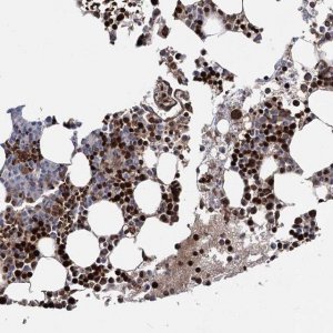 Anti-RNF6 antibody produced in rabbit 