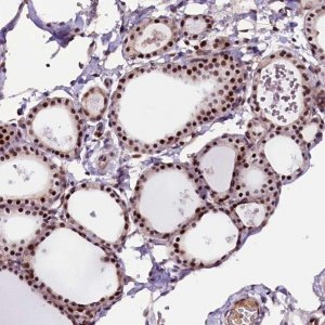 Anti-RNMT antibody produced in rabbit 