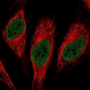 Anti-RNPC3 antibody produced in rabbit 