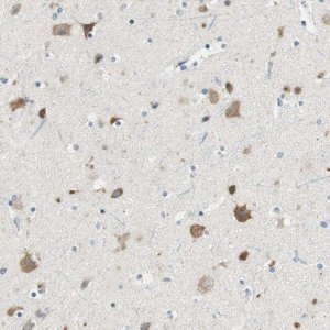 Anti-RORB antibody produced in rabbit 