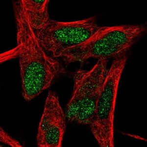 Anti-RORB antibody produced in rabbit 