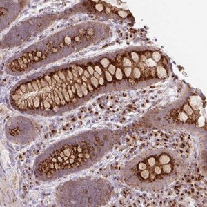 Anti-RP11-111M22.2 antibody produced in rabbit 