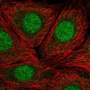 Anti-RP9 antibody produced in rabbit 