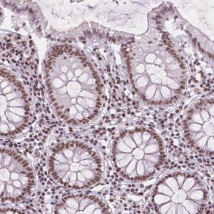 Anti-RPA4 antibody produced in rabbit 