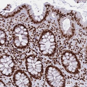 Anti-RPAP1 antibody produced in rabbit 