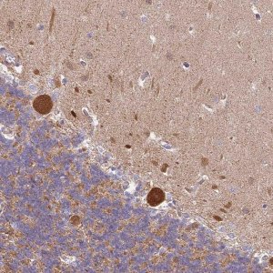 Anti-RPAP2 antibody produced in rabbit 