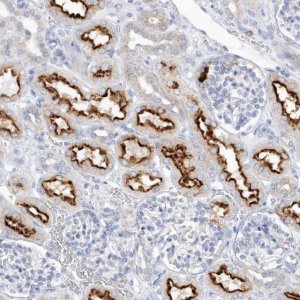 Anti-RPE antibody produced in rabbit 