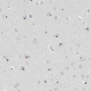 Anti-RPF1 antibody produced in rabbit 