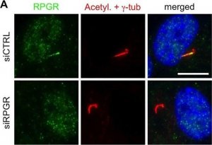 Anti-RPGR antibody produced in rabbit 
