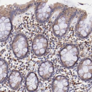 Anti-RPL11 antibody produced in rabbit HPA002734-100UL
