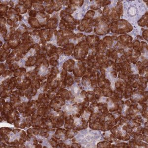 Anti-RPL18 antibody produced in rabbit 