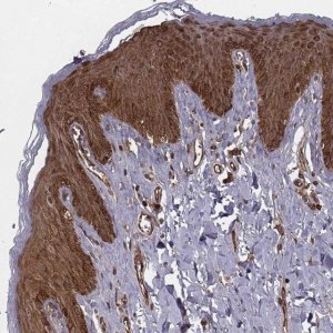 Anti-RPL3 antibody produced in rabbit 
