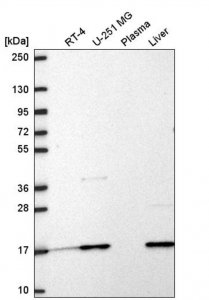 Anti-RPL31 antibody produced in rabbit HPA072263-100UL