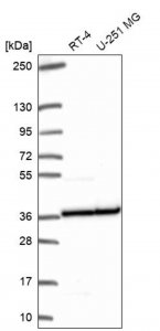 Anti-RPL5 antibody produced in rabbit HPA054444-100UL