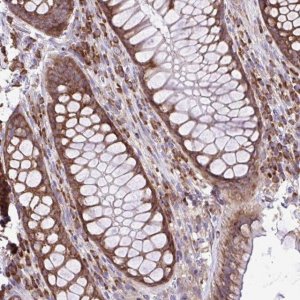 Anti-RPL7 antibody produced in rabbit HPA058373-100UL