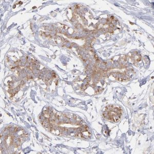 Anti-RPLP0 antibody produced in rabbit 