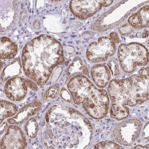 Anti-RPLP2 antibody produced in rabbit 
