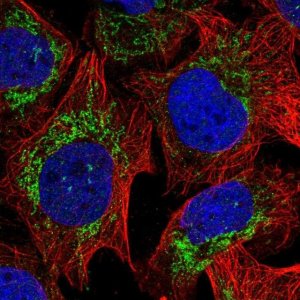Anti-RPLP2 antibody produced in rabbit 