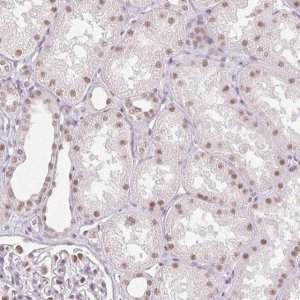 Anti-RPRD1B antibody produced in rabbit 