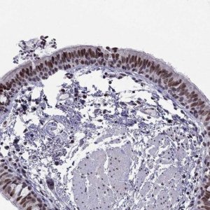 Anti-RPRD2 antibody produced in rabbit 
