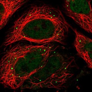 Anti-RPRD2 antibody produced in rabbit 