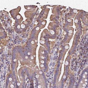 Anti-RPRML antibody produced in rabbit 