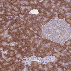 Anti-RPS10 antibody produced in rabbit HPA048084-100UL