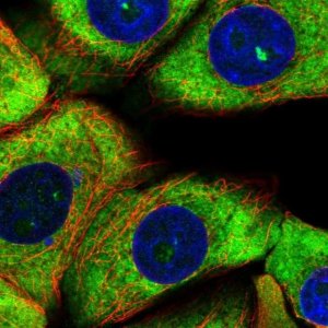 Anti-RPS11 antibody produced in rabbit HPA049719-100UL