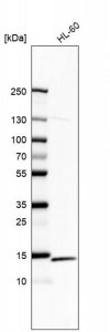 Anti-RPS12 antibody produced in rabbit HPA006365-100UL