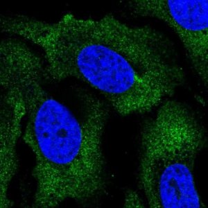 Anti-RPS2 antibody produced in rabbit 
