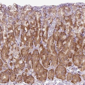 Anti-RPS23 antibody produced in rabbit HPA054853-100UL