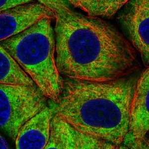 Anti-RPS23 antibody produced in rabbit HPA054853-100UL