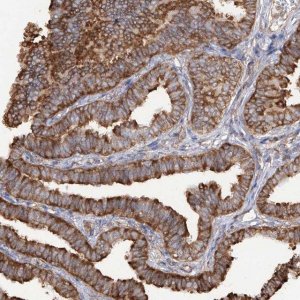 Anti-RPS25 antibody produced in rabbit 
