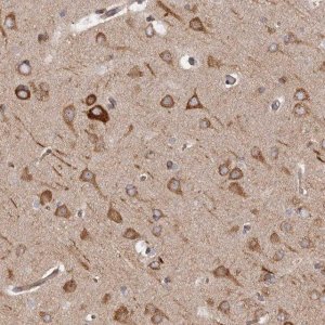 Anti-RPS6 antibody produced in rabbit HPA031153-100UL