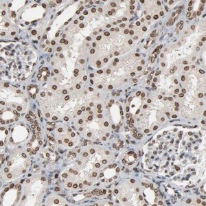 Anti-RPS6KA3 antibody produced in rabbit 