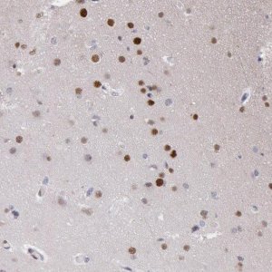 Anti-RPS6KA5 antibody produced in rabbit HPA001274-100UL