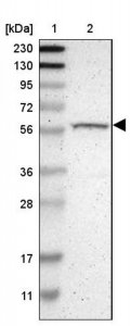 Anti-RPS6KB2 antibody produced in rabbit 