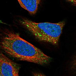 Anti-RPTOR antibody produced in rabbit 