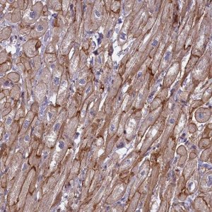 Anti-RRAD antibody produced in rabbit 
