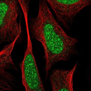 Anti-RREB1 antibody produced in rabbit 