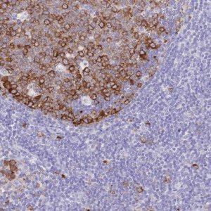 Anti-RRM1 antibody produced in rabbit 