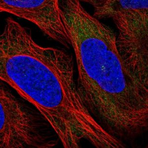 Anti-RRM1 antibody produced in rabbit 