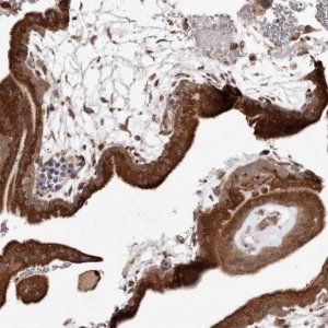 Anti-RRM2B antibody produced in rabbit 