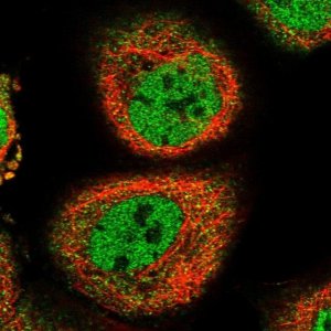 Anti-RRM2B antibody produced in rabbit 