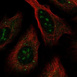 Anti-RRNAD1 antibody produced in rabbit 