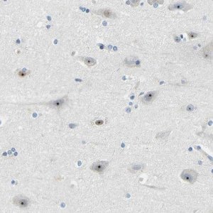 Anti-RRP1 antibody produced in rabbit 