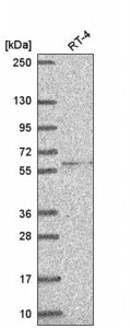 Anti-RRP8 antibody produced in rabbit HPA057562-100UL